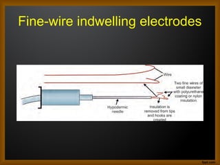 Fine-wire indwelling electrodes
 