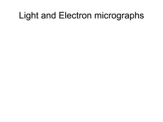 Light and Electron micrographs 
 