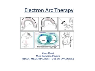 Electron Arc Therapy
Vinay Desai
M.Sc Radiation Physics
KIDWAI MEMORIAL INSTITUTE OF ONCOLOGY
 