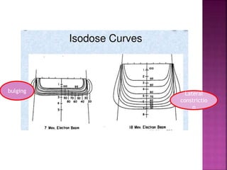Lateral
constrictio
n
bulging
 
