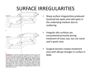 SURFACE IRREGULARITIES
• Sharp surface irregularities produced
localised hot spots and cold spots in
the underlying medium due to
scattering
• Irregular skin surfaces are
encountered primarily during
treatment of nose, eye, ear, ear canal
and in groin area
• Surgical excision creates treatment
area with abrupt changes in surface in
body
 