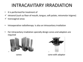 INTRACAVITARY IRRADIATION
• It is performed for treatment of
 intraoral (such as floor of mouth, tongue, soft palate, retromolar trigone)
 transvaginal areas
• Intraoperative radiotherapy is also an intracavitary irradiation
• For intracavitary irradiation specially design cones and adaptors are
required
cones cone with adaptor
 