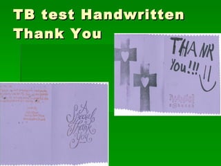 TB test Handwritten Thank You 