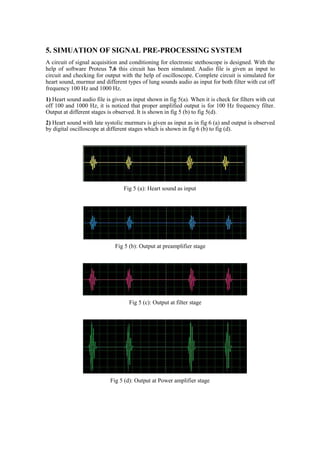 5. SIMUATION OF SIGNAL PRE-PROCESSING SYSTEM
A circuit of signal acquisition and conditioning for electronic stethoscope is designed. With the
help of software Proteus 7.6 this circuit has been simulated. Audio file is given as input to
circuit and checking for output with the help of oscilloscope. Complete circuit is simulated for
heart sound, murmur and different types of lung sounds audio as input for both filter with cut off
frequency 100 Hz and 1000 Hz.
1) Heart sound audio file is given as input shown in fig 5(a). When it is check for filters with cut
off 100 and 1000 Hz, it is noticed that proper amplified output is for 100 Hz frequency filter.
Output at different stages is observed. It is shown in fig 5 (b) to fig 5(d).
2) Heart sound with late systolic murmurs is given as input as in fig 6 (a) and output is observed
by digital oscilloscope at different stages which is shown in fig 6 (b) to fig (d).
Fig 5 (a): Heart sound as input
Fig 5 (b): Output at preamplifier stage
Fig 5 (c): Output at filter stage
Fig 5 (d): Output at Power amplifier stage
 