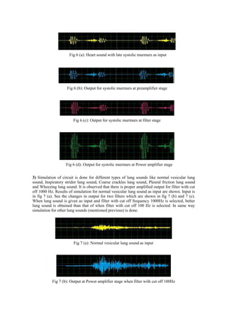 Fig 6 (a): Heart sound with late systolic murmurs as input
Fig 6 (b): Output for systolic murmurs at preamplifier stage
Fig 6 (c): Output for systolic murmurs at filter stage
Fig 6 (d): Output for systolic murmurs at Power amplifier stage
3) Simulation of circuit is done for different types of lung sounds like normal vesicular lung
sound, Inspiratory stridor lung sound, Coarse crackles lung sound, Pleural friction lung sound
and Wheezing lung sound. It is observed that there is proper amplified output for filter with cut
off 1000 Hz. Results of simulation for normal vesicular lung sound as input are shown. Input is
in fig 7 (a). See the changes in output for two filters which are shown in fig 7 (b) and 7 (c).
When lung sound is given as input and filter with cut off frequency 1000Hz is selected, better
lung sound is obtained than that of when filter with cut off 100 Hz is selected. In same way
simulation for other lung sounds (mentioned previous) is done.
Fig 7 (a): Normal vesicular lung sound as input
Fig 7 (b): Output at Power amplifier stage when filter with cut off 100Hz
 