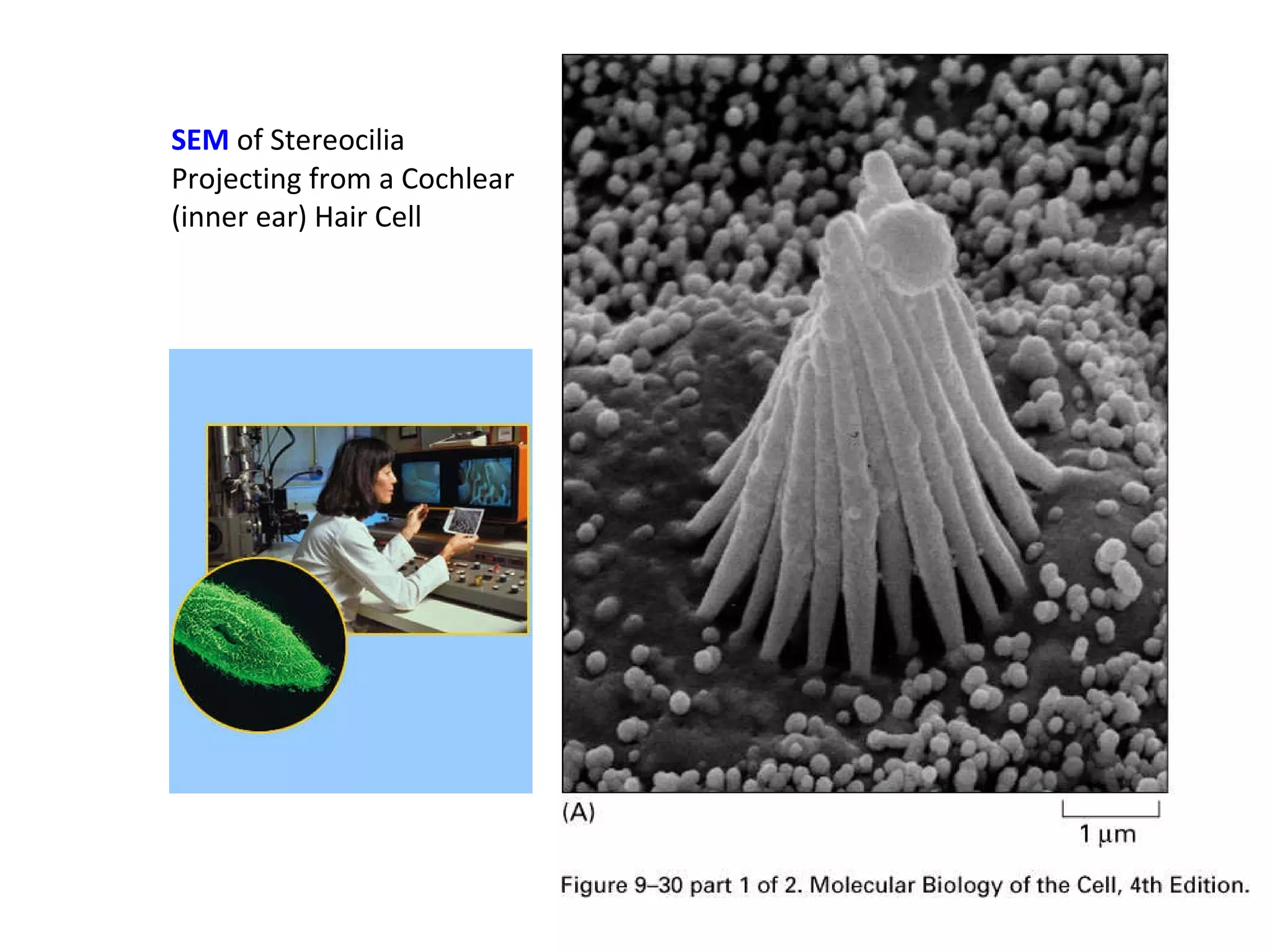 SEM  of Stereocilia Projecting from a Cochlear (inner ear) Hair Cell 
