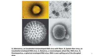 A, Adenovirus, an icosahedral nonenveloped DNA virus with fibers. B, Epstein-Barr virus, an
icosahedral enveloped DNA virus. C, Rotavirus, a nonenveloped, wheel-like, RNA virus. D,
Paramyxovirus, a spherical enveloped RNA virus. RNA is seen spilling out of the disrupted
virus
36
 