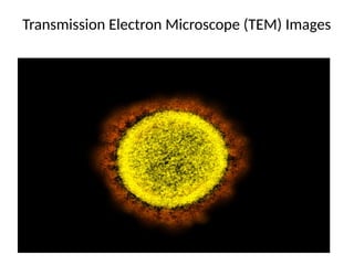 Transmission Electron Microscope (TEM) Images
 
