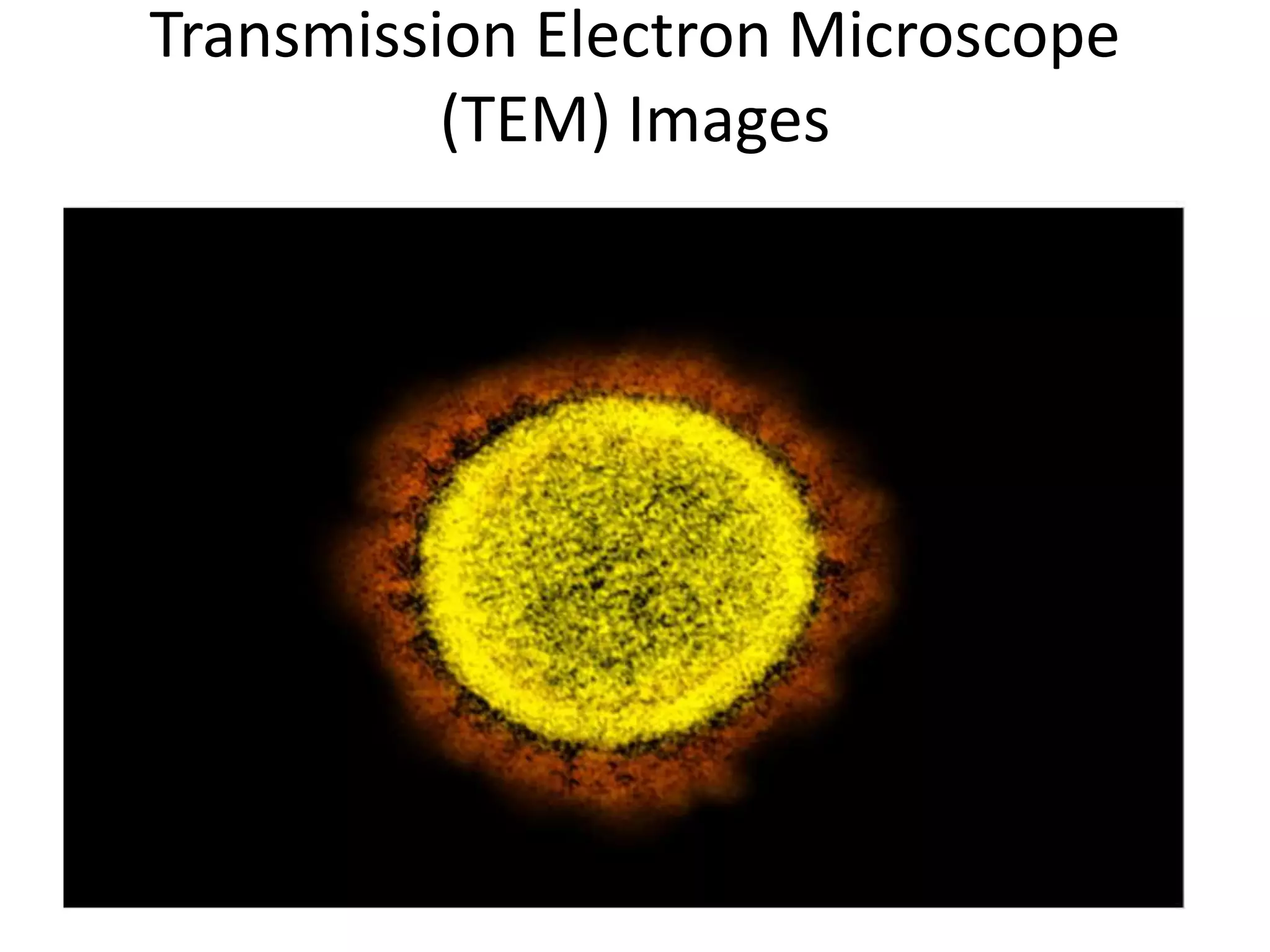 Transmission Electron Microscope
(TEM) Images
 