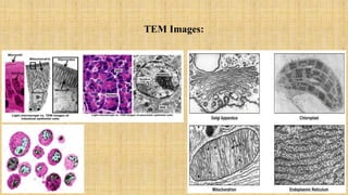 TEM Images:
11
 
