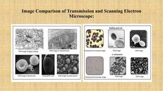 Image Comparison of Transmission and Scanning Electron
Microscope:
17
 