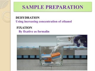 SAMPLE PREPARATION
DEHYDRATION
Using increasing concentration of ethanol
FIXATION
By fixative as formalin
 