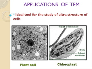 APPLICATIONS OF TEM
Ideal tool for the study of ultra structure of
cells
Chloroplast
Plant cell
 