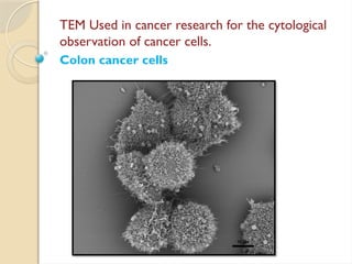 TEM Used in cancer research for the cytological
observation of cancer cells.
Colon cancer cells
 