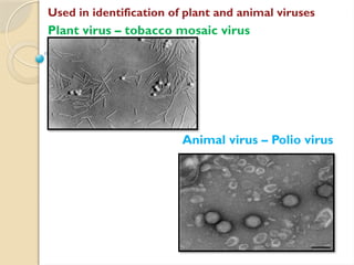 Used in identification of plant and animal viruses
Plant virus – tobacco mosaic virus
Animal virus – Polio virus
 