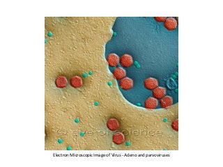 Electron Microscopic Image of Virus - Adeno and parvoviruses
 
