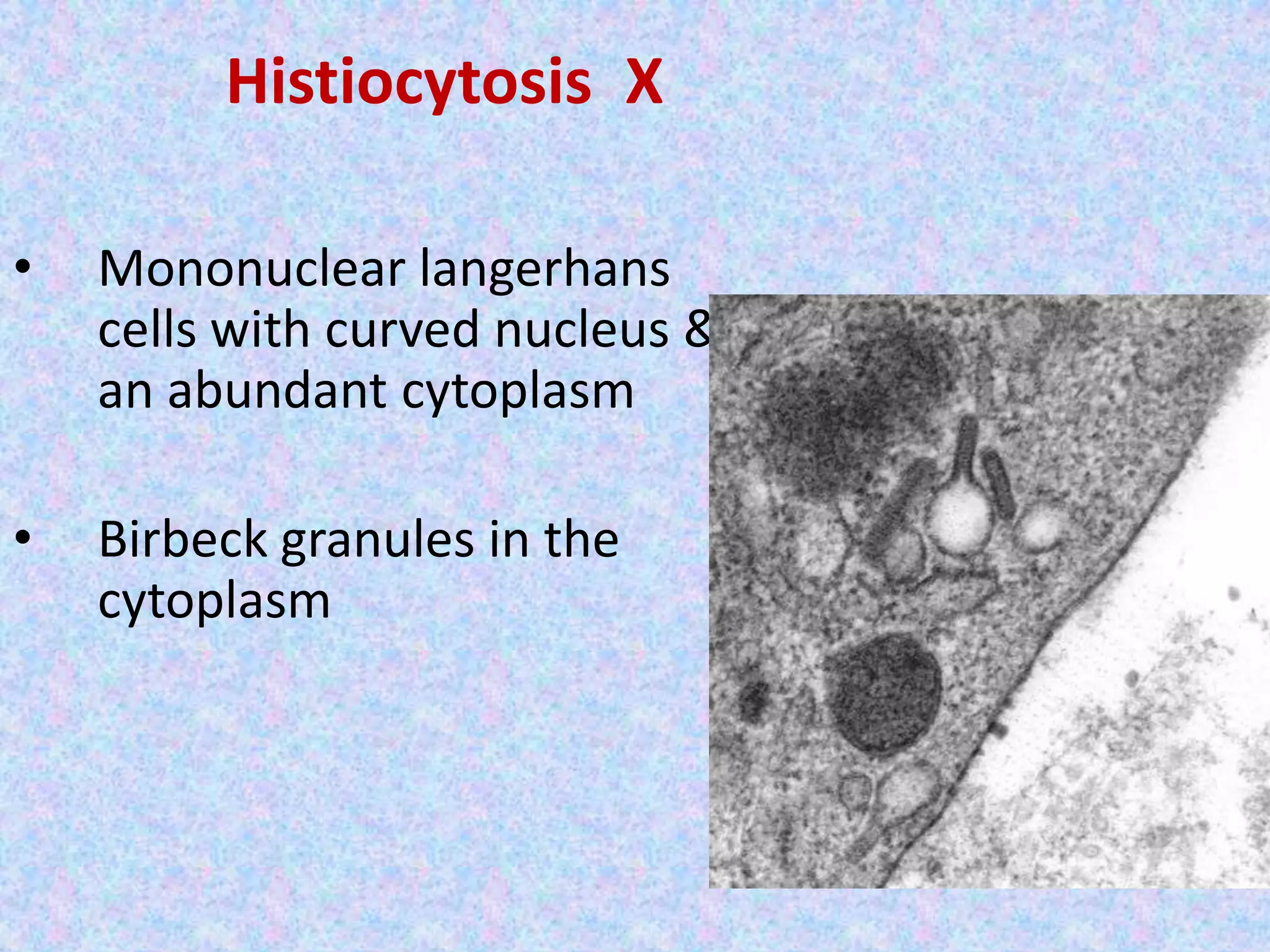 Histiocytosis X

•   Mononuclear langerhans
    cells with curved nucleus &
    an abundant cytoplasm

•   Birbeck granules in the
    cytoplasm
 