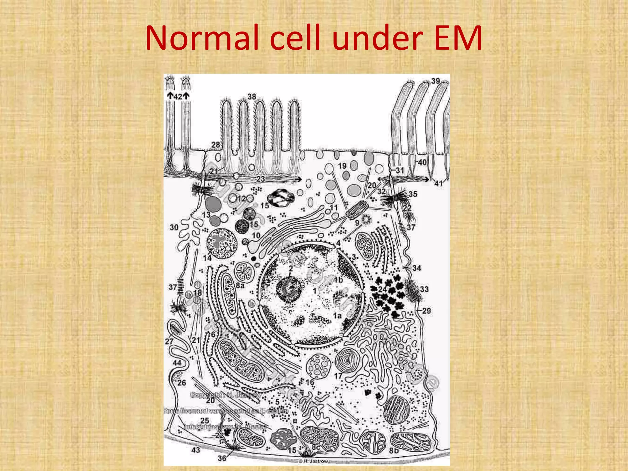 Normal cell under EM
 