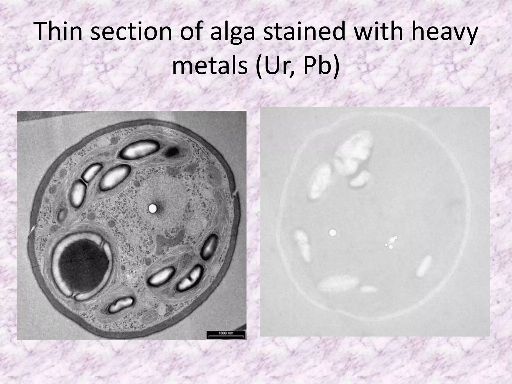 Thin section of alga stained with heavy
            metals (Ur, Pb)
 