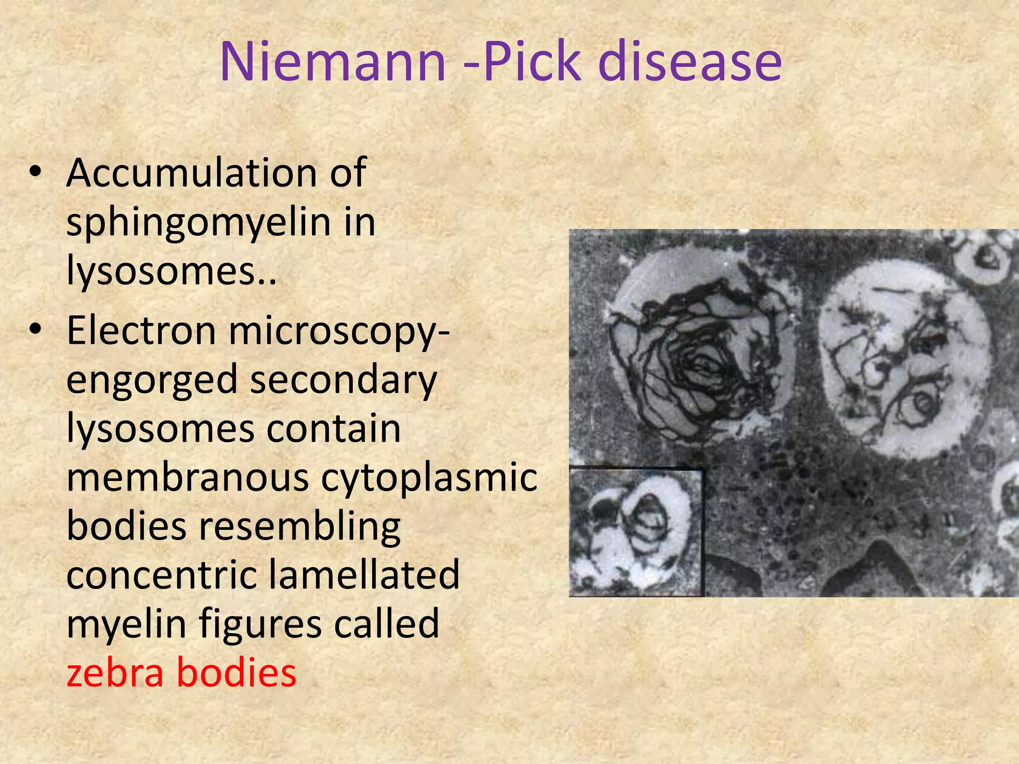 Niemann -Pick disease
• Accumulation of
  sphingomyelin in
  lysosomes..
• Electron microscopy-
  engorged secondary
  lysosomes contain
  membranous cytoplasmic
  bodies resembling
  concentric lamellated
  myelin figures called
  zebra bodies
 