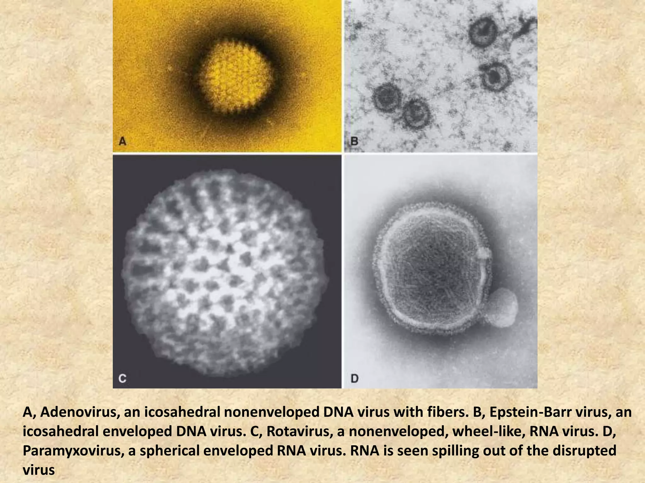 A, Adenovirus, an icosahedral nonenveloped DNA virus with fibers. B, Epstein-Barr virus, an
icosahedral enveloped DNA virus. C, Rotavirus, a nonenveloped, wheel-like, RNA virus. D,
Paramyxovirus, a spherical enveloped RNA virus. RNA is seen spilling out of the disrupted
virus
 