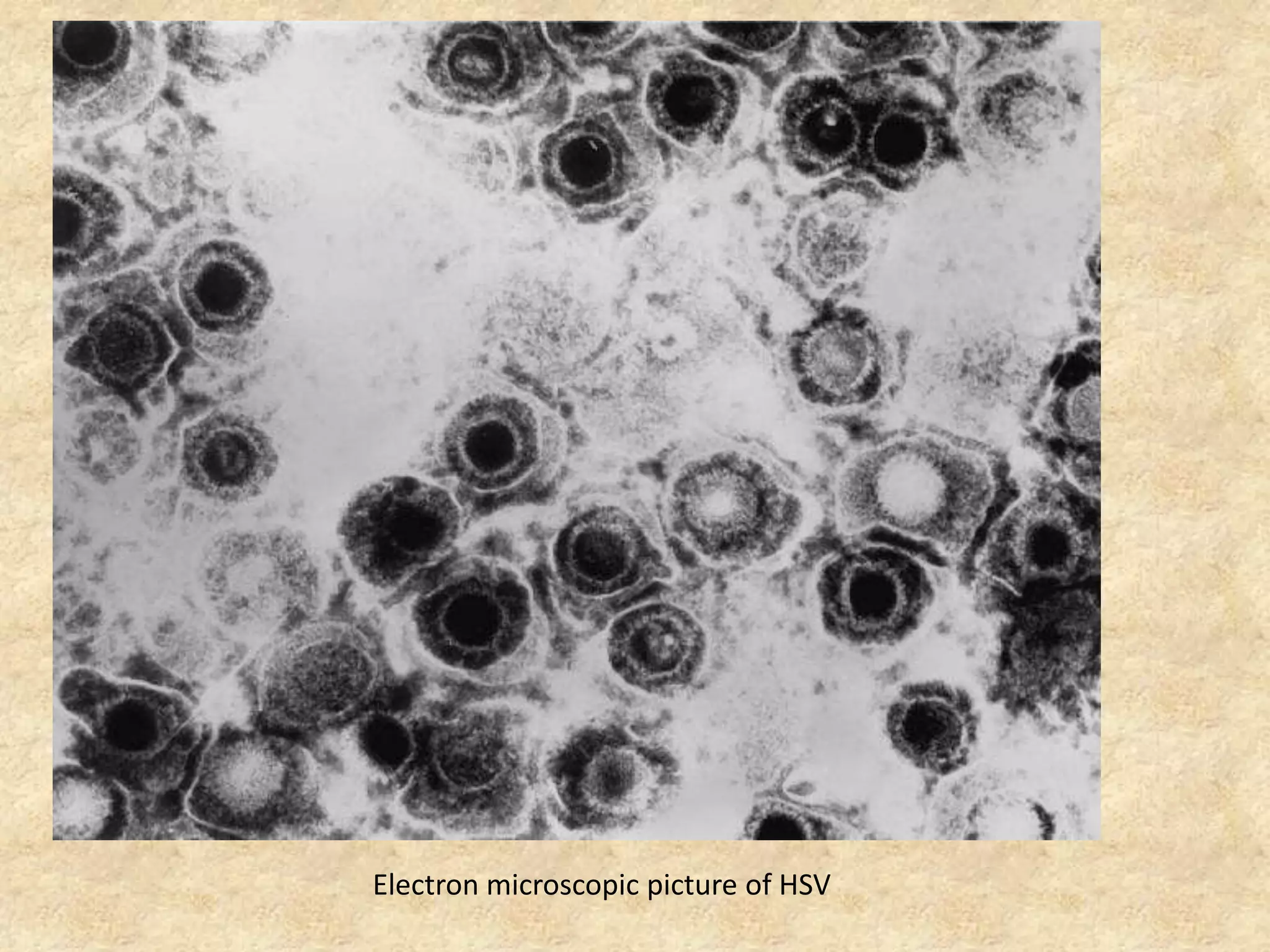 Electron microscopic picture of HSV
 