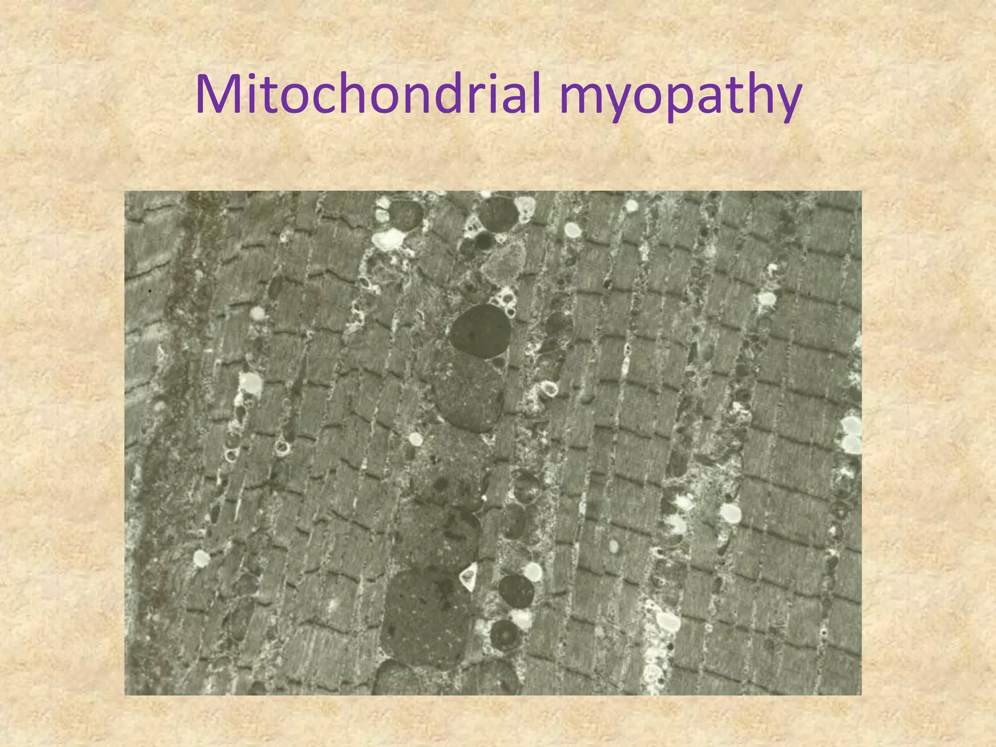 Mitochondrial myopathy
 