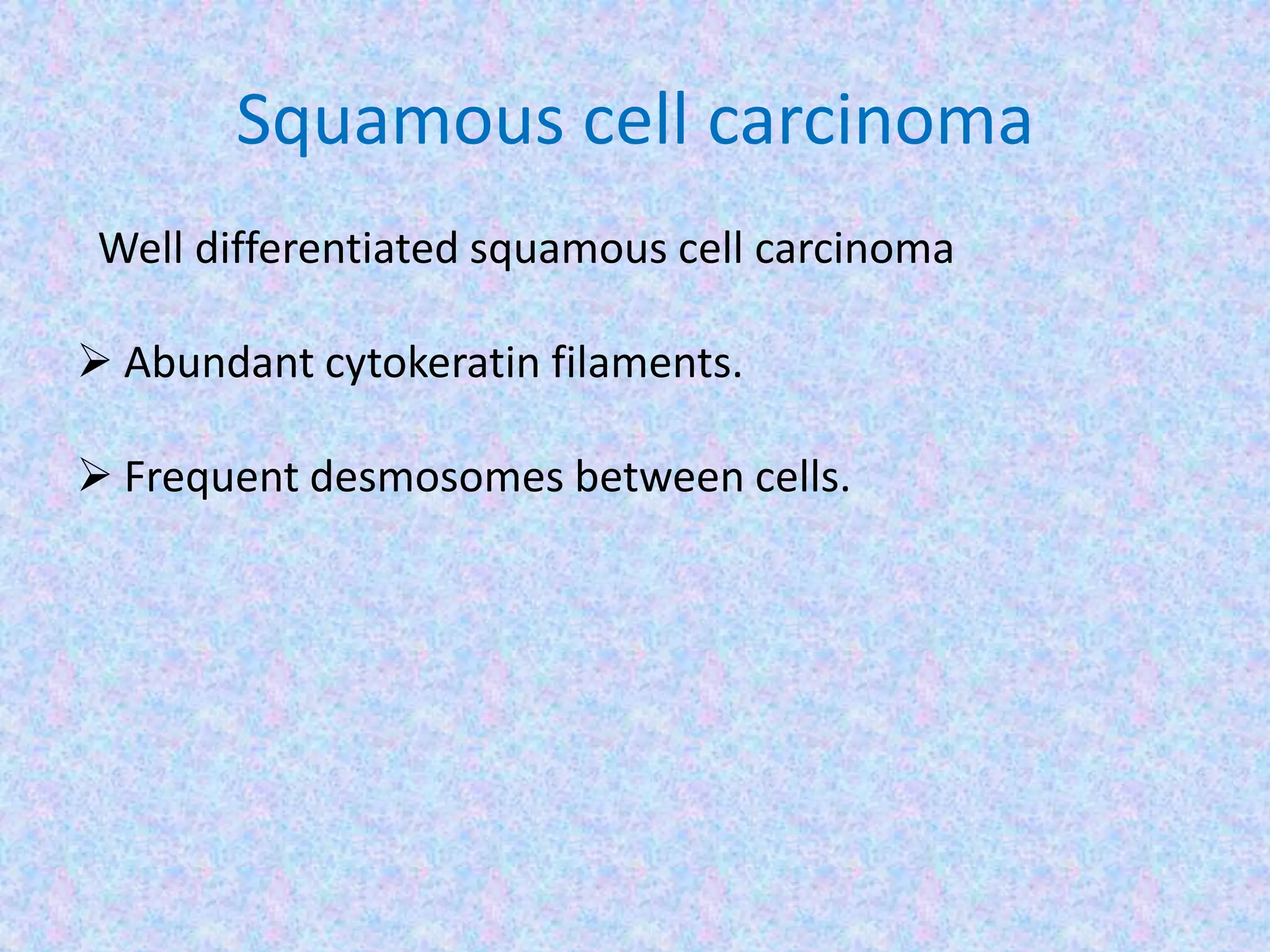 Squamous cell carcinoma
 Well differentiated squamous cell carcinoma

 Abundant cytokeratin filaments.

 Frequent desmosomes between cells.
 