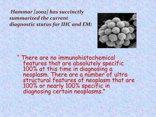 Hammar [2002] has succinctly
summarized the current
diagnostic status for IHC and EM:




   “ There are no immunohistochemical
     features that are absolutely specific
     100% at this time in diagnosing a
     neoplasm. There are a number of ultra
     structural features of neoplasm that are
     100% or nearly 100% specific in
     diagnosing certain neoplasms."
 