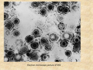 Electron microscopic picture of HSV
 