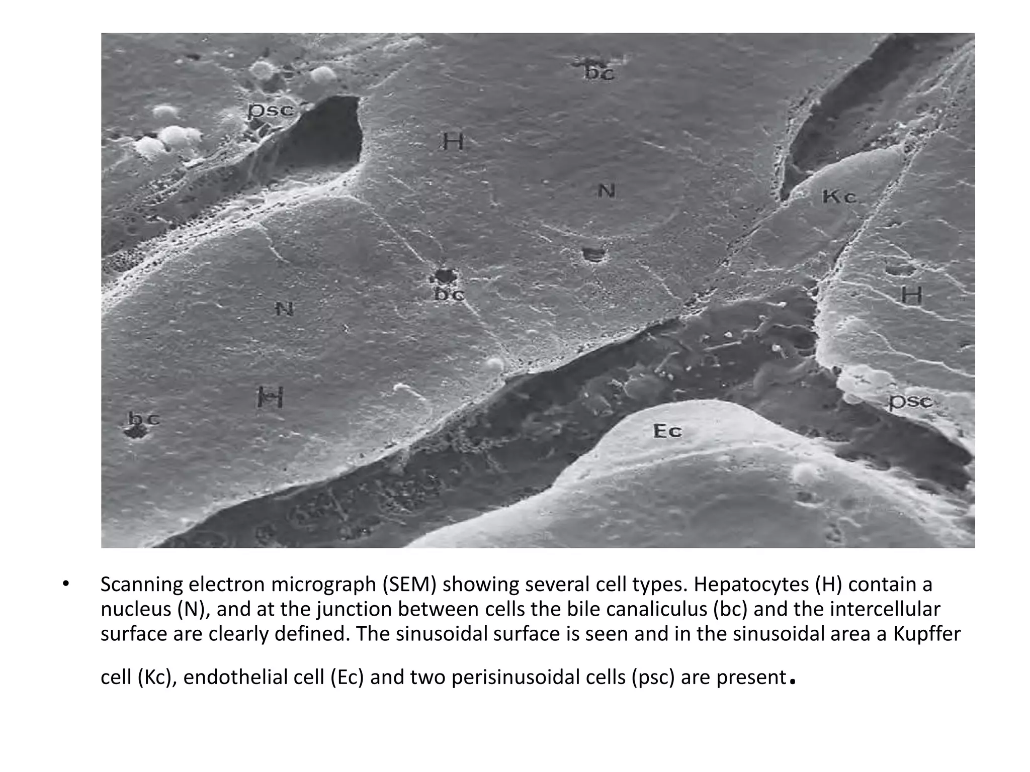 Electron microscopy of liver diseases- 2020 | PPTX