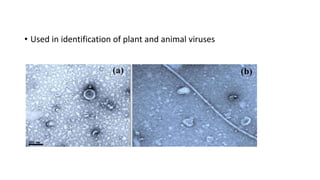 • Used in identification of plant and animal viruses
 