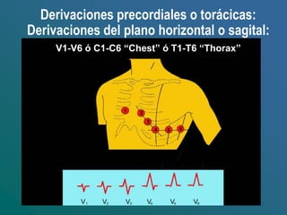 Derivaciones precordiales o torácicas:
Derivaciones del plano horizontal o sagital:
V1-V6 ó C1-C6 “Chest” ó T1-T6 “Thorax”
 
