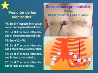 Posición de los
electrodos:
V1: En el 4º espacio intercostal,
con el borde paraesternal dcho.
V2: En el 4º espacio intercostal
con el borde paraesternal izdo.
V3: Entre V2 y V4.
V4: En el 5º espacio intercostal
con línea medio clavicular izda.
V5: En el 5º espacio intercostal
con la línea axilar anterior.
V6: En el 5º espacio intercostal
con la línea axilar media..
Derivaciones precordiales:
V1-V6
C1-C6 “Chest” ó T1-T6 “Thorax”
 
