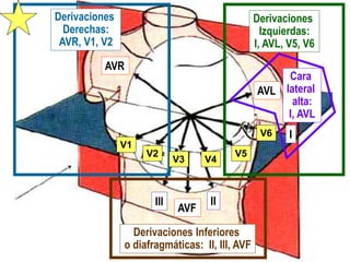 Derivaciones
Derechas:
AVR, V1, V2
Derivaciones Inferiores
o diafragmáticas: II, III, AVF
Derivaciones
Izquierdas:
I, AVL, V5, V6
Cara
lateral
alta:
I, AVL
AVR
AVL
AVF
I
II
III
V1
V2
V3 V4
V5
V6
 