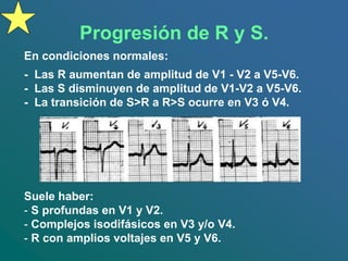 Progresión de R y S.
En condiciones normales:
- Las R aumentan de amplitud de V1 - V2 a V5-V6.
- Las S disminuyen de amplitud de V1-V2 a V5-V6.
- La transición de S>R a R>S ocurre en V3 ó V4.
Suele haber:
- S profundas en V1 y V2.
- Complejos isodifásicos en V3 y/o V4.
- R con amplios voltajes en V5 y V6.
 