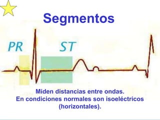 Segmentos
Miden distancias entre ondas.
En condiciones normales son isoeléctricos
(horizontales).
 