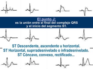 El punto J:
es la unión entre el final del complejo QRS
y el inicio del segmento ST.
ST Descendente, ascendente u horizontal.
ST Horizontal, suprradesnivelado o infradesnivelado.
ST Cóncavo, convexo, rectificado...
 