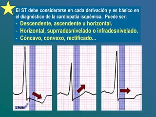 El ST debe considerarse en cada derivación y es básico en
el diagnóstico de la cardiopatía isquémica. Puede ser:
- Descendente, ascendente u horizontal.
- Horizontal, suprradesnivelado o infradesnivelado.
- Cóncavo, convexo, rectificado...
 