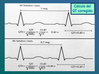 Cálculo del
QT corregido:
 
