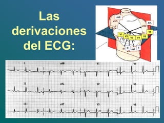 Las
derivaciones
del ECG:
AVR
AVL
AVF
I
II
III
V1
V2
V3 V4
V5
V6
 