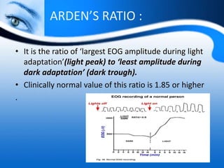 ARDEN’S RATIO :
• It is the ratio of ‘largest EOG amplitude during light
adaptation’(light peak) to ‘least amplitude during
dark adaptation’ (dark trough).
• Clinically normal value of this ratio is 1.85 or higher
.
 