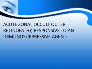 ACUTE ZONAL OCCULT OUTER
RETINOPATHY, RESPONSIVE TO AN
IMMUNOSUPPRESSIVE AGENT:
 