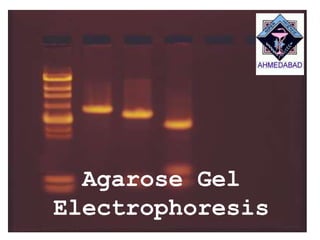 Agarose Gel
Electrophoresis
 