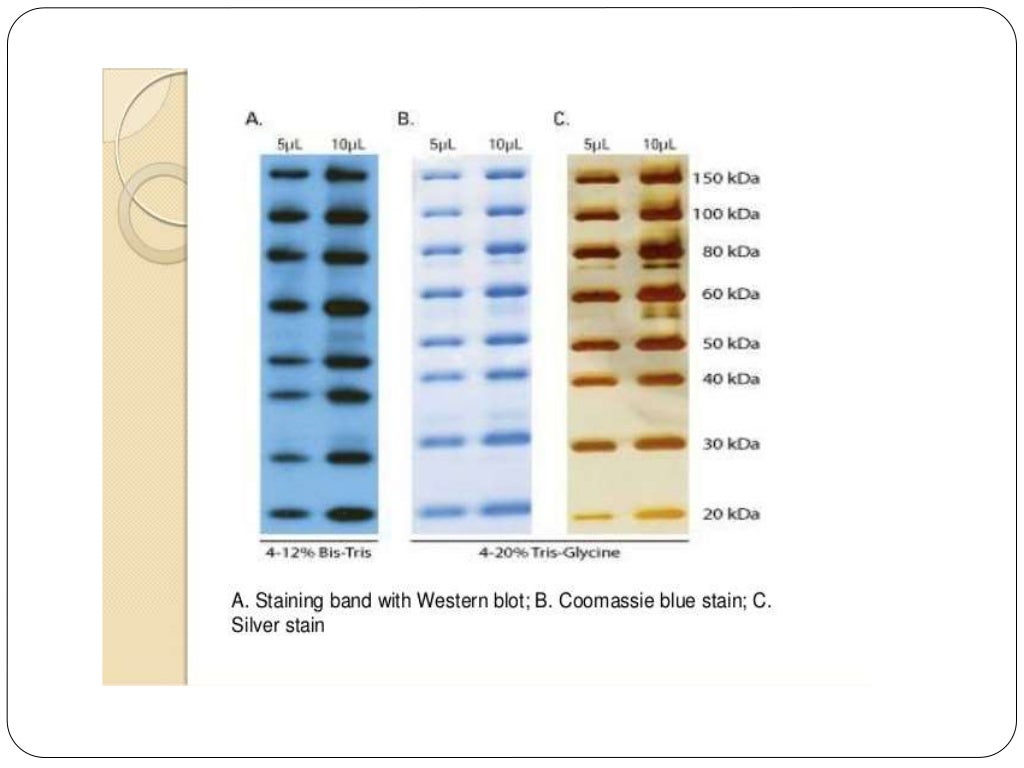 Electrophoresis SDSPAGE