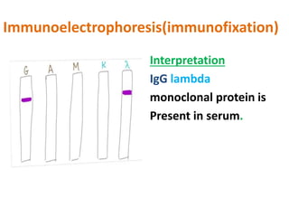 Immunofixation Electrophoresis Ppt – TBNSTF