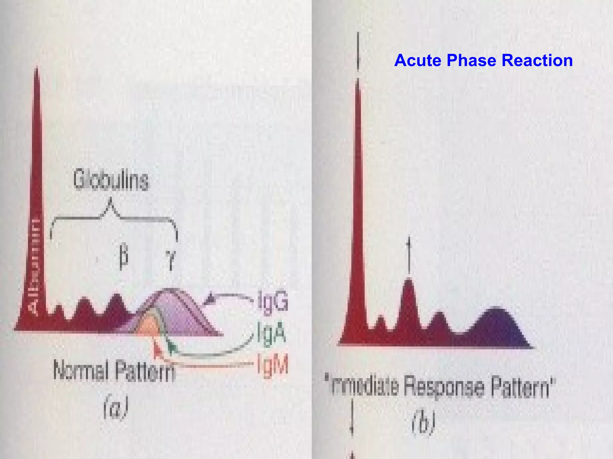 Acute Phase Reaction
 