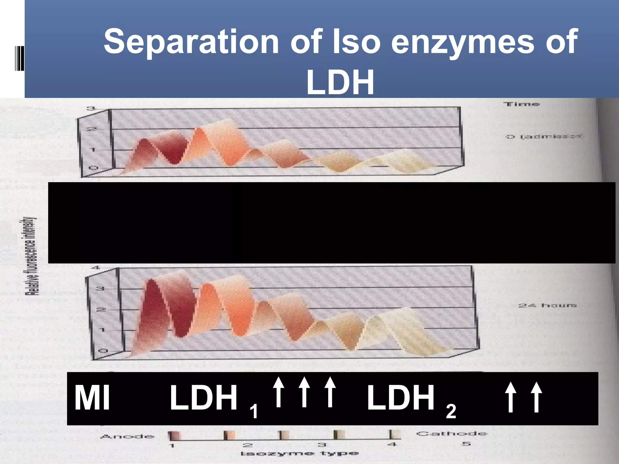 Separation of Iso enzymes of
LDH
MI LDH 1 LDH 2
 