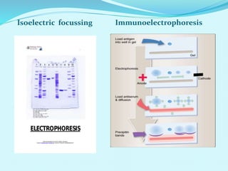 Isoelectric focussing Immunoelectrophoresis
 