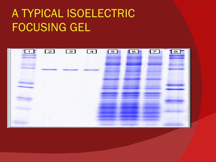 Electrophoresis presentation